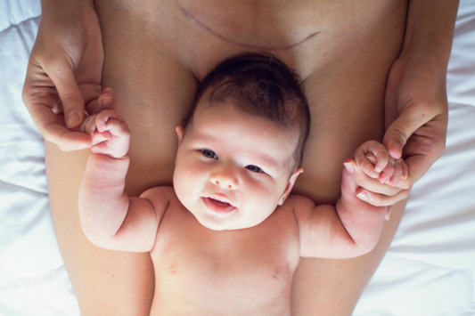 Everything to Know About C-Section Recovery and Aftercare