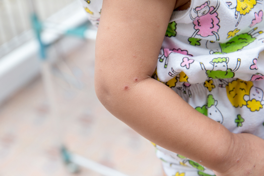 What Parents Need to Know About Hand, Foot, and Mouth Disease